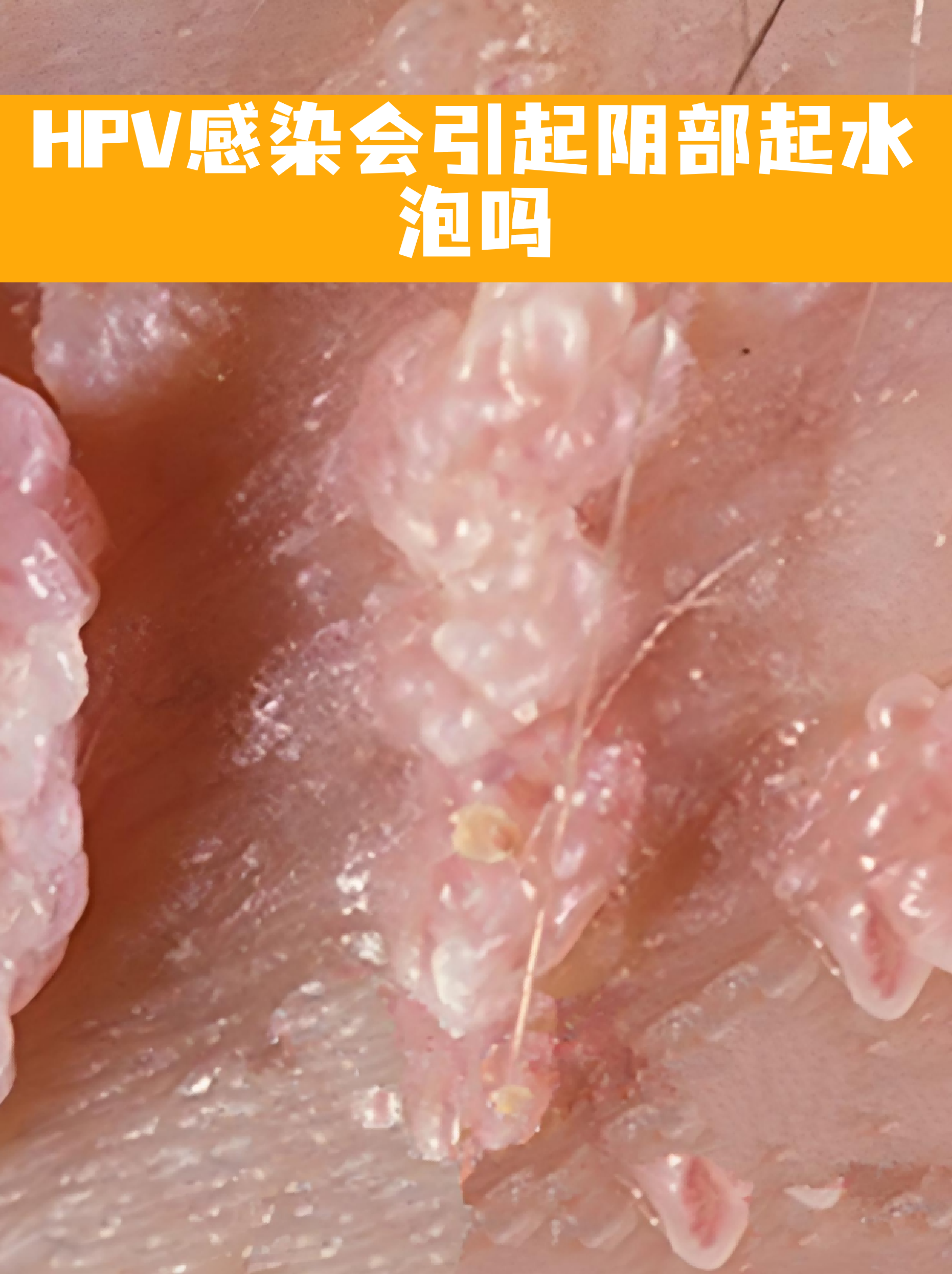 河南多地出现这种病毒︰(河南出现病毒了吗)-第2张图片